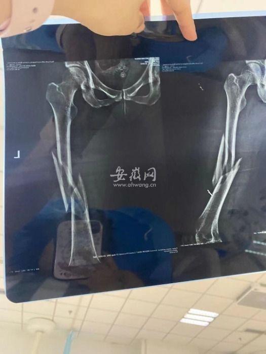CQ9电子 CQ9传奇电子男健身教练帮女生开腿动作近乎惹人争议她们的老公真不介意？(图11)